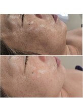 イチグラム(Ichi Glam)/タラソトリートメント