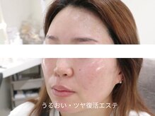 マイ フェア レディ(MY FAIR LADY)の雰囲気（うるおい・ツヤ復活エステ）