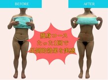 エクラ(Eclat)/Eclatの痩身★BeforeAfter7