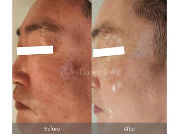 エングロー 錦糸町店(Englow)/