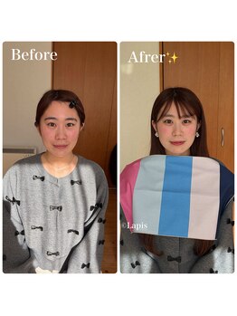 ルン(Lun.)/お客様のビフォーアフター