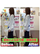 ヒデ整体院(Hide整体院)/猫背矯正骨盤矯正B/A肩こり腰痛