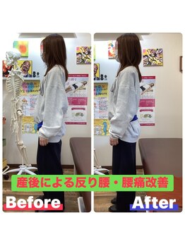ヒデ整体院(Hide整体院)/猫背矯正骨盤矯正B/A肩こり腰痛