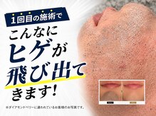 ダイアモンドベリー 静岡店