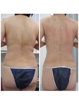 アンジェ あゆむ鍼灸院/人気NO.1 Ange式メディセル施術