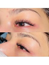 カトルセ(Catorce)/Wフラットラッシュ