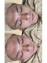 ミーミドットアイ(Mi-mi.i)/メンズも大歓迎★