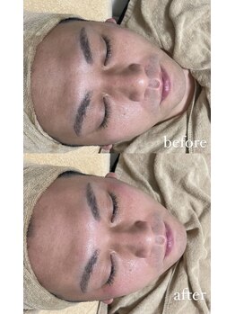 ミーミドットアイ(Mi-mi.i)/メンズも大歓迎★