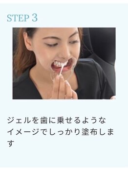 ホワイトニングショップ 新潟店/ジェルを歯にしっかり塗ります