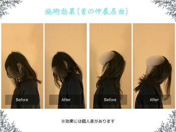 ボディ リセット アンド デザイン(Body Reset & Design)/【施術例】ビフォーアフター