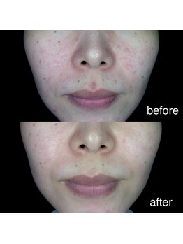 ベル(bell)/クリスティーナ肌管理