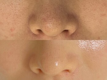 マリーメリー(marie merry)/セラピール