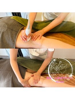 モア 多治見店(MORE)の写真/【MORE式エステ】大人女性も美脚でいたい！そんな思いを叶えます◇高品質施術で気になる箇所にも集中ケア◎