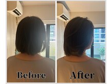 整体ラルース 中目黒(LALUZ)/50代 女性 ストレートネック改善