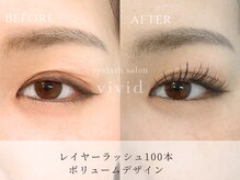 ビビッド(vivid)/【LEDレイヤーラッシュ100本】