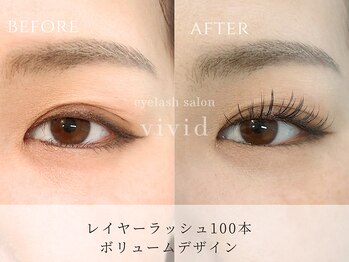 ビビッド(vivid)/【LEDレイヤーラッシュ100本】