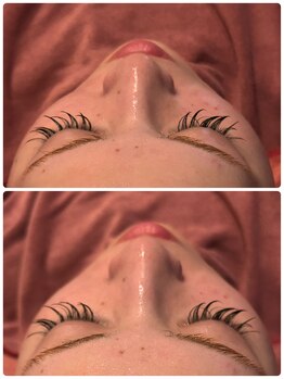 ボディーケアサロン マリン(Body Care Salon MARIN)/【フェイシャル】スッキリ小顔に