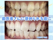 毛抜き屋 可児店/美★白セルフホワイトニング