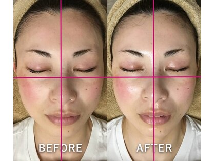 リエル(RiEL)の写真