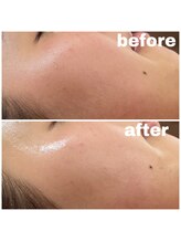 リンク(LiNK)/☆ノーファンでも綺麗☆