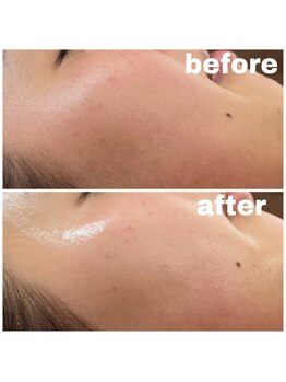 リンク(LiNK)/☆ノーファンでも綺麗☆