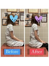 ナオル整体 宮崎院(NAORU整体)/20代女性施術事例【猫背肩こり】