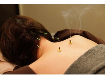 つぼぜん/【肩こりに鍼+整体】