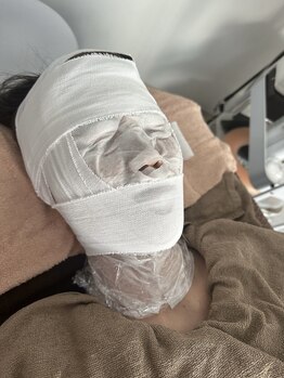 リン(琳 rin)/バンテージカーボキシ炭酸パック