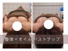 叶'エル 本町 心斎橋院/バストをしっかり支える姿勢に