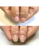アーティネイルズ(Aaty Nails)/こんなお悩みありませんか？