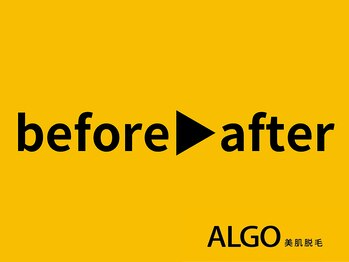 アルゴ 福井店(ALGO)/ビフォーアフターをご紹介♪