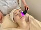 シーボンビューティーオアシス 銀座店(C’BON Beauty Oasis)の写真/【デンキバリコース¥5500】リフトアップで小顔へ☆デンキバリで叶える理想の素肌へ!ハリと潤いを同時にケア