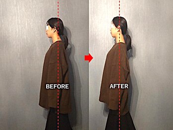 アトラス/初回のお客様のBefore＆after