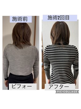 新リンパサロン 大阪/むくみスッキリ