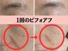 【先着5名】モニター★最先端美容！エステ版ダーマ×コスメジェット★-5歳肌