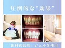 エヌエーホワイトニング たまプラーザ店(NAホワイトニング)