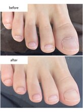 ケアプラス(care plus)/フットネイルケア