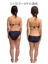 エスエー(SA)/Before/after