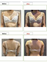 エステティック レイビス 銀座店(RAYVIS)/バスト