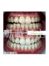 ホワイトニングサロン 札幌店/【ホワイトニング】#札幌#大通り