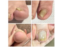 エムネイル(M nail)の雰囲気（巻き爪やフットトラブルでお悩みの方、お気軽にご相談ください！）