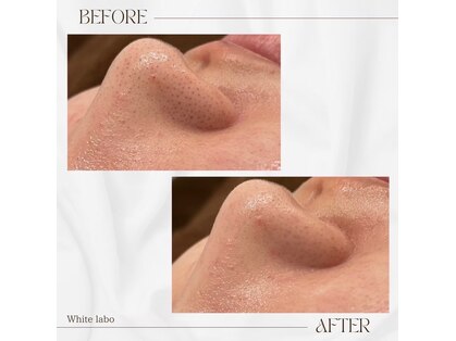 ホワイトラボ 川西(White labo)の写真