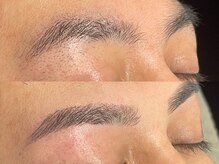 アンベリール(Embellir)/眉毛beforeafter