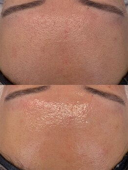 クラルテアンドコー(Salon Clarte&Co.)/美肌フェイシャルワックス◎初回