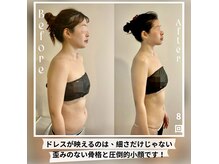 蒼(so)の雰囲気（ブライダルエステ整体。猫背/巻き肩/骨格の歪みによる体型崩れ…）