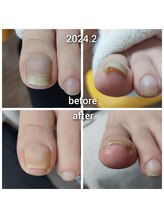 爪切り屋 足楽/ＵＰジェル