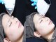 ロエ(Loe)の写真/痛みは最小限!効果は最大限!最新の"LED脱毛"で最短半年で脱毛卒業♪鼻毛/耳毛/眉毛もしっかり照射します◎