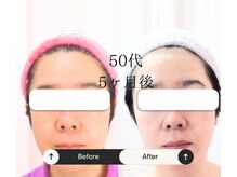 ゆう/50代女性が続々と若々しく変身！