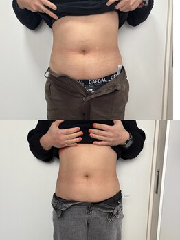 レアレア(Lea l'ea)/