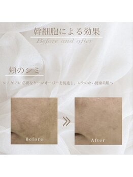 アイネイル 小倉(ai nail)/人気NO.1 トータルフェイシャル